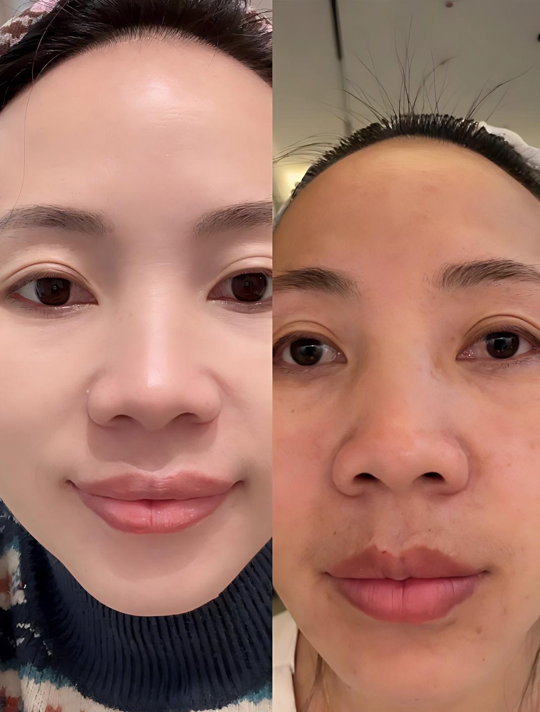 调肤前-后
