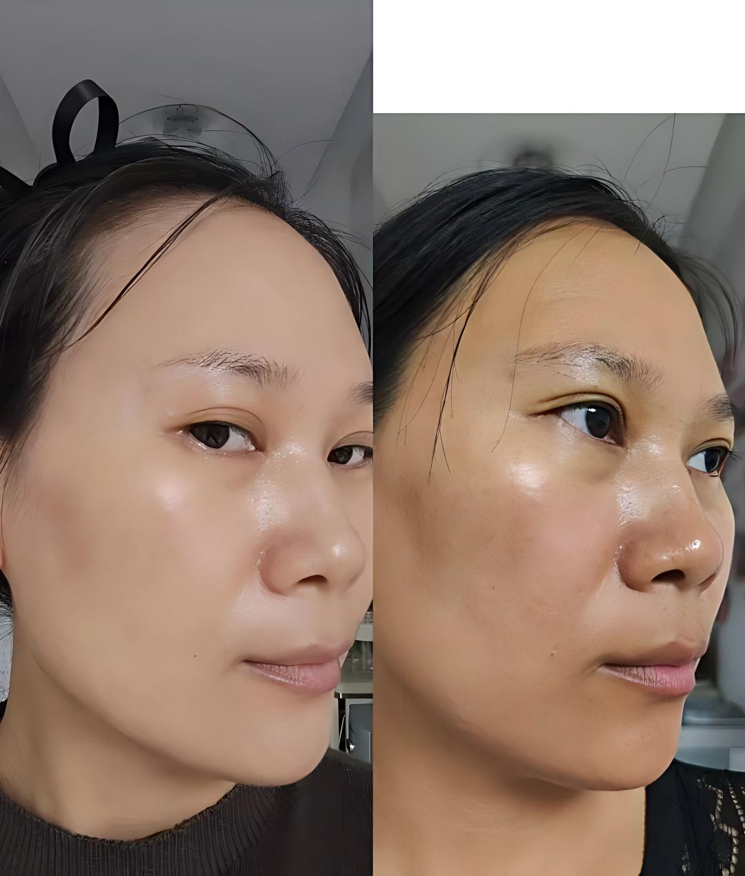 调肤前-后