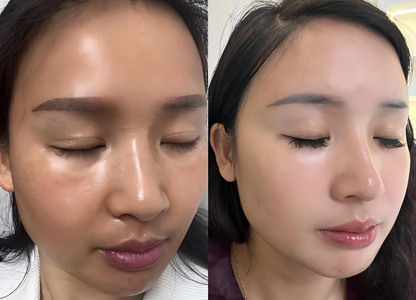 调肤前-后